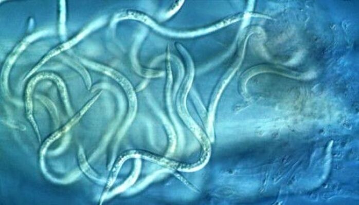 Seperti apa parasit nematoda dalam tubuh manusia