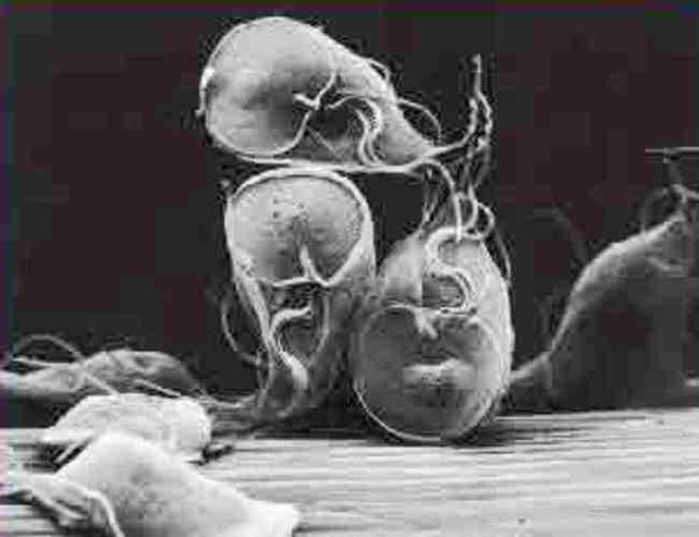 parasit protozoa Giardia